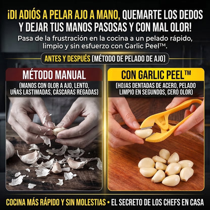 GARLIC PEEL™ Pelador de Ajos Ergonómico con Cuchillas de Acero 2X1