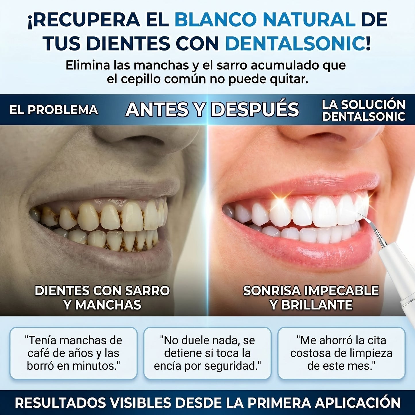 DentalSonic Eliminación De Sarro Con Raspador Dental Ultrasónico